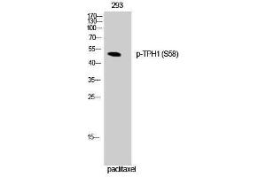 Western Blotting (WB) image for anti-Tryptophan Hydroxylase 1 (TPH1) (pSer58) antibody (ABIN3173282) (Tryptophan Hydroxylase 1 anticorps  (pSer58))