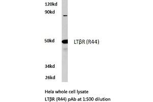 Western blot (WB) analysis of LTβR antibody in extracts from HeLa cells. (LTBR anticorps)