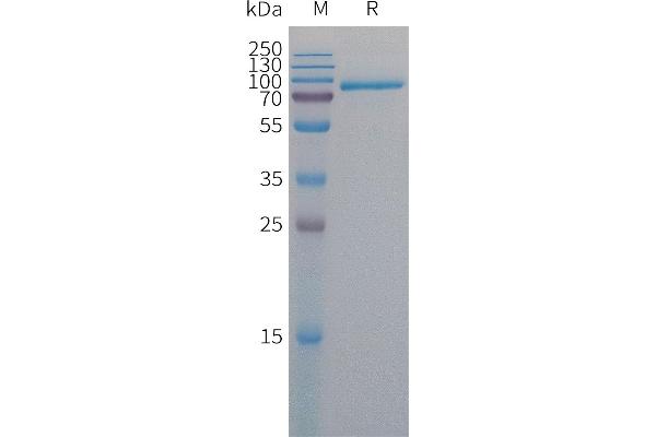 MFI2 Protein (AA 20-708) (His tag)