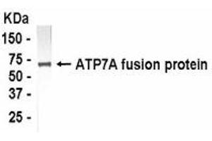 Western Blotting (WB) image for anti-ATPase, Cu++ Transporting, alpha Polypeptide (ATP7A) (AA 1407-1500) antibody (ABIN2467776) (ATP7A anticorps  (AA 1407-1500))