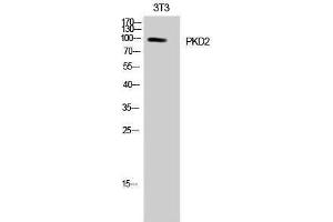 Western Blotting (WB) image for anti-Polycystic Kidney Disease 2 (Autosomal Dominant) (PKD2) (Tyr654) antibody (ABIN3186484) (PKD2 anticorps  (Tyr654))