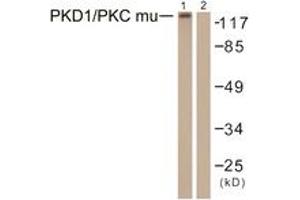 Western Blotting (WB) image for anti-Protein Kinase D1 (PRKD1) (AA 429-478) antibody (ABIN2888772) (PKC mu anticorps  (AA 429-478))
