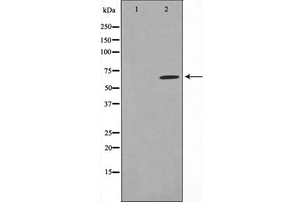 PIAS1 anticorps  (N-Term)