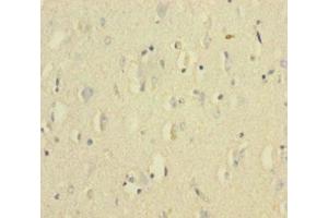 Immunohistochemistry of paraffin-embedded human brain tissue using ABIN7175654 at dilution of 1:100 (VWF anticorps  (AA 1-273))