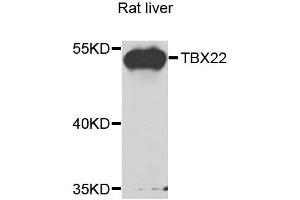 Western blot analysis of extracts of rat liver, using TBX22 antibody. (T-Box 22 anticorps  (AA 291-520))