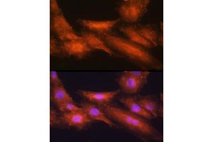 Immunofluorescence analysis of H9C2 cells using [KO Validated] HINT1 Rabbit pAb  at dilution of 1:100 (40x lens). (HINT1 anticorps  (AA 1-126))