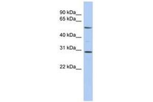 Image no. 1 for anti-V-Rel Reticuloendotheliosis Viral Oncogene Homolog B (RELB) (AA 395-444) antibody (ABIN6744395) (RELB anticorps  (AA 395-444))