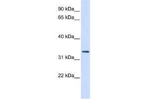 WB Suggested Anti-FBXO25 Antibody Titration:  0. (FBXO25 anticorps  (N-Term))