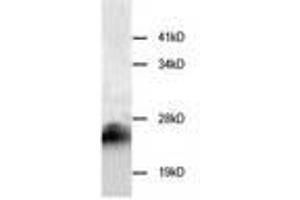 Image no. 1 for anti-Cystatin B (Stefin B) (CSTB) antibody (ABIN791546) (CSTB anticorps)