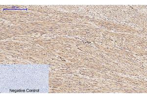 Immunohistochemical analysis of paraffin-embedded human uterus tissue. (PI3K p85/p55 anticorps  (pTyr199, pTyr467))