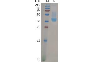 Human C Protein, hFc Tag on SDS-PAGE under reducing condition. (CXCR4 Protein (AA 1-38) (Fc Tag))