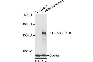Western blot analysis of extracts of NIH/3T3 cells, using Phospho-HDAC5-S498 antibody (ABIN2987596) at 1/2000 dilution. (HDAC5 anticorps  (pSer498))