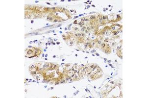 Immunohistochemistry of paraffin-embedded human stomach using NPPA antibody. (NPPA anticorps)