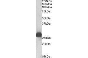 Western Blotting (WB) image for anti-Glutathione S-Transferase alpha 3 (GSTA3) (AA 169-182) antibody (ABIN793282) (GSTA3 anticorps  (AA 169-182))