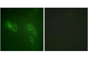 Immunofluorescence analysis of NIH-3T3 cells, using IR (Ab-999) Antibody. (IR (AA 881-930) anticorps)