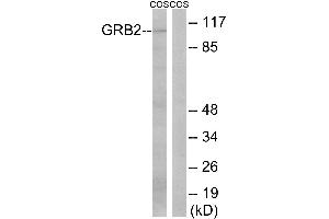 Immunohistochemistry analysis of paraffin-embedded human colon carcinoma tissue using GRB2 (Ab-159) antibody. (GAB2 anticorps  (Ser159))