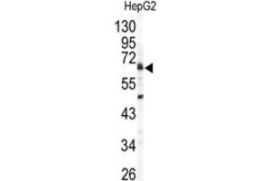 Western Blotting (WB) image for anti-Arylsulfatase B (ARSB) antibody (ABIN3003229) (Arylsulfatase B anticorps)