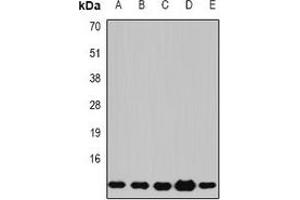 Western blot analysis of Beta 2 Microglobulin expression in Jurkat (A), COS7 (B), K562 (C), mouse lung (D), mouse liver (E) whole cell lysates. (beta-2 Microglobulin anticorps)