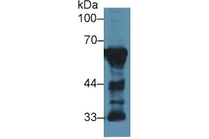 Detection of CaN in Rat Cerebrum lysate using Polyclonal Antibody to Calcineurin (CaN) (CAN anticorps  (AA 7-301))