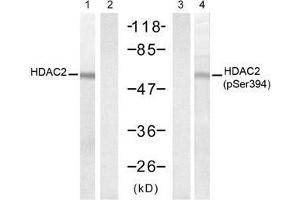 Western blot analysis of extracts from HT-29 cells untreated or treated with UV (20min), using HDAC2 (Ab-394) antibody (E021140, Lane 1 and 2) and HDAC2 (Phospho-Ser394) antibody (E011191, Lane 3 and 4). (HDAC2 anticorps  (pSer394))
