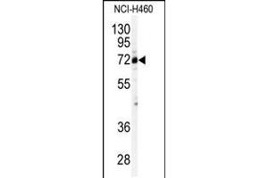 Western blot analysis of anti-CSTF2 Antibody in NCI-H460 cell line lysates (35ug/lane). (CSTF2 anticorps  (N-Term))