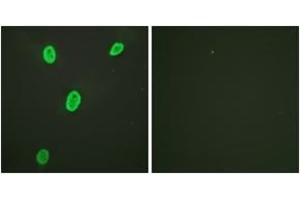 Immunofluorescence analysis of HeLa cells, using Histone H4 (Acetyl-Lys12) Antibody. (Histone H4 anticorps  (acLys12))