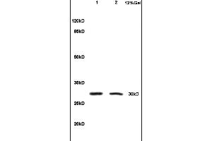 Formalin-fixed and paraffin embedded rat colitis tissue labeled with Anti-IL-1 Beta/IL-1B Polyclonal Antibody, Unconjugated (ABIN872644) at 1:200, followed by conjugation to the secondary antibody and DAB staining (IL-1 beta anticorps  (AA 161-269))