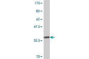 Western Blot detection against Immunogen (35. (CD3G anticorps  (AA 23-111))