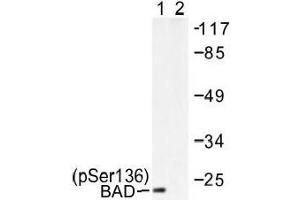 Image no. 1 for anti-BCL2-Associated Agonist of Cell Death (BAD) (pSer136), (pSer99) antibody (ABIN317969) (BAD anticorps  (pSer99, pSer136))
