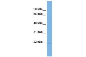 C13ORF28 antibody used at 1 ug/ml to detect target protein. (SPACA7 anticorps  (Middle Region))