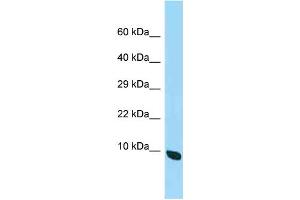 WB Suggested Anti-2410015M20Rik Antibody Titration: 1. (Chromosome 19 Open Reading Frame 70 (C19ORF70) (C-Term) anticorps)