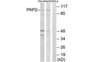 Western Blotting (WB) image for anti-Plakophilin 2 (PKP2) (AA 632-681) antibody (ABIN2890508) (Plakophilin 2 anticorps  (AA 632-681))
