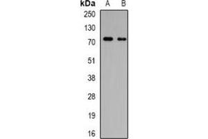 Western blot analysis of GalNAc-T3 expression in MCF7 (A), SW480 (B) whole cell lysates. (GALNT3 anticorps)