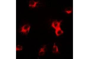 Immunofluorescent analysis of delta-Sarcoglycan staining in U2OS cells. (SGCD anticorps)
