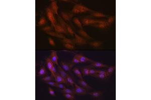 Immunofluorescence analysis of C6 cells using K48-linkage Specific Ubiquitin Rabbit mAb (ABIN1680189, ABIN3017871, ABIN3017872 and ABIN7101530) at dilution of 1:100 (40x lens). (Ubiquitin B anticorps)