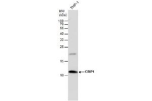 CRIP1 antibody detects CRIP1 protein by western blot analysis. (CRIP1 anticorps  (C-Term))