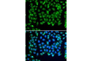 Immunofluorescence analysis of MCF-7 cells using RNF8 antibody (ABIN6128649, ABIN6147049, ABIN6147051 and ABIN6218319). (RNF8 anticorps  (AA 1-260))