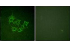 Immunofluorescence analysis of HuvEc cells, using COT (Phospho-Thr290) Antibody. (CROT anticorps  (pThr290))