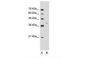 Image no. 1 for anti-Keratin 13 (KRT13) (C-Term) antibody (ABIN203408) (Cytokeratin 13 anticorps  (C-Term))