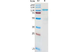 Human L Protein, hFc Tag on SDS-PAGE under reducing condition. (LRRC32 Protein (AA 20-627) (Fc Tag))