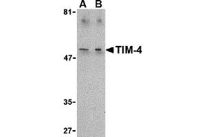 Western Blotting (WB) image for anti-T-Cell Immunoglobulin and Mucin Domain Containing 4 (TIMD4) (C-Term) antibody (ABIN1030736) (TIMD4 anticorps  (C-Term))