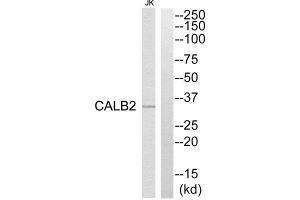 Western Blotting (WB) image for anti-Calbindin 2 (CALB2) (Internal Region) antibody (ABIN1850972) (Calretinin anticorps  (Internal Region))