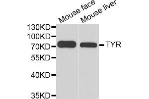 Western blot analysis of extracts of various cell lines, using TYR antibody. (TYR anticorps)