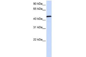 WB Suggested Anti-UMPS Antibody Titration:  0. (UMPS anticorps  (C-Term))