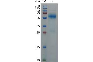 SARS-CoV-2 Nucleocapsid (P13L, E31del, R32del, S33del, R203K, G204R) Protein, His Tag on SDS-PAGE under reducing condition. (SARS-CoV-2 Nucleocapsid Protein (SARS-CoV-2 N) (Pro13Leu-Mutant) (His tag))