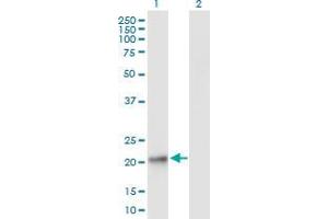 Lane 1: GPX8 transfected lysate ( 23. (GPX8 293T Cell Transient Overexpression Lysate(Denatured))