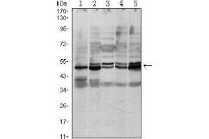 Western blot analysis using SMAD3 mouse mAb against A549 (1), Hela (2), Jurkat (3), PC-2 (4) and NIH/3T3 (5) cell lysate. (SMAD3 anticorps)
