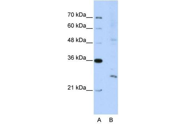 EXOSC4 anticorps  (N-Term)