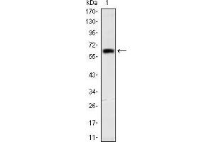 Western Blotting (WB) image for anti-Orthodenticle Homeobox 2 (OTX2) antibody (ABIN969332)