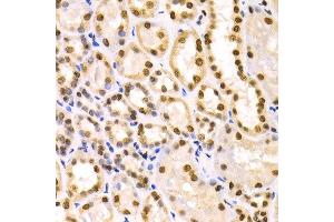 Immunohistochemistry of paraffin-embedded human kidney using IKZF1 antibody at dilution of 1:100 (x400 lens). (IKZF1 anticorps)